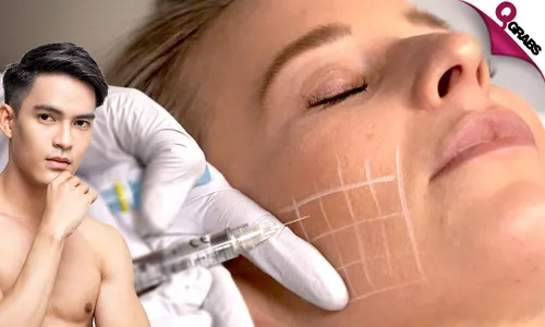 Mesotherapy for Under-Eyes, Face OR Intimate Areas!